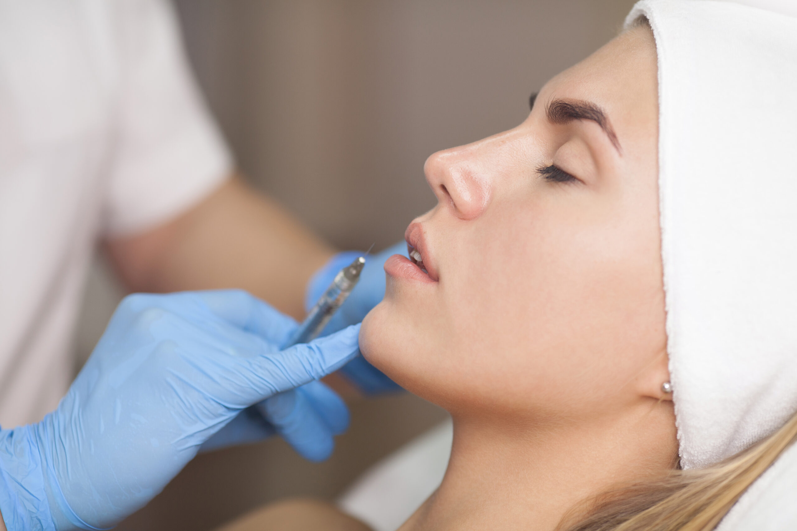 Aesthetic treatment session with a woman receiving lip filler injections, showcasing a healthcare professional in blue gloves preparing the syringe near her lips.