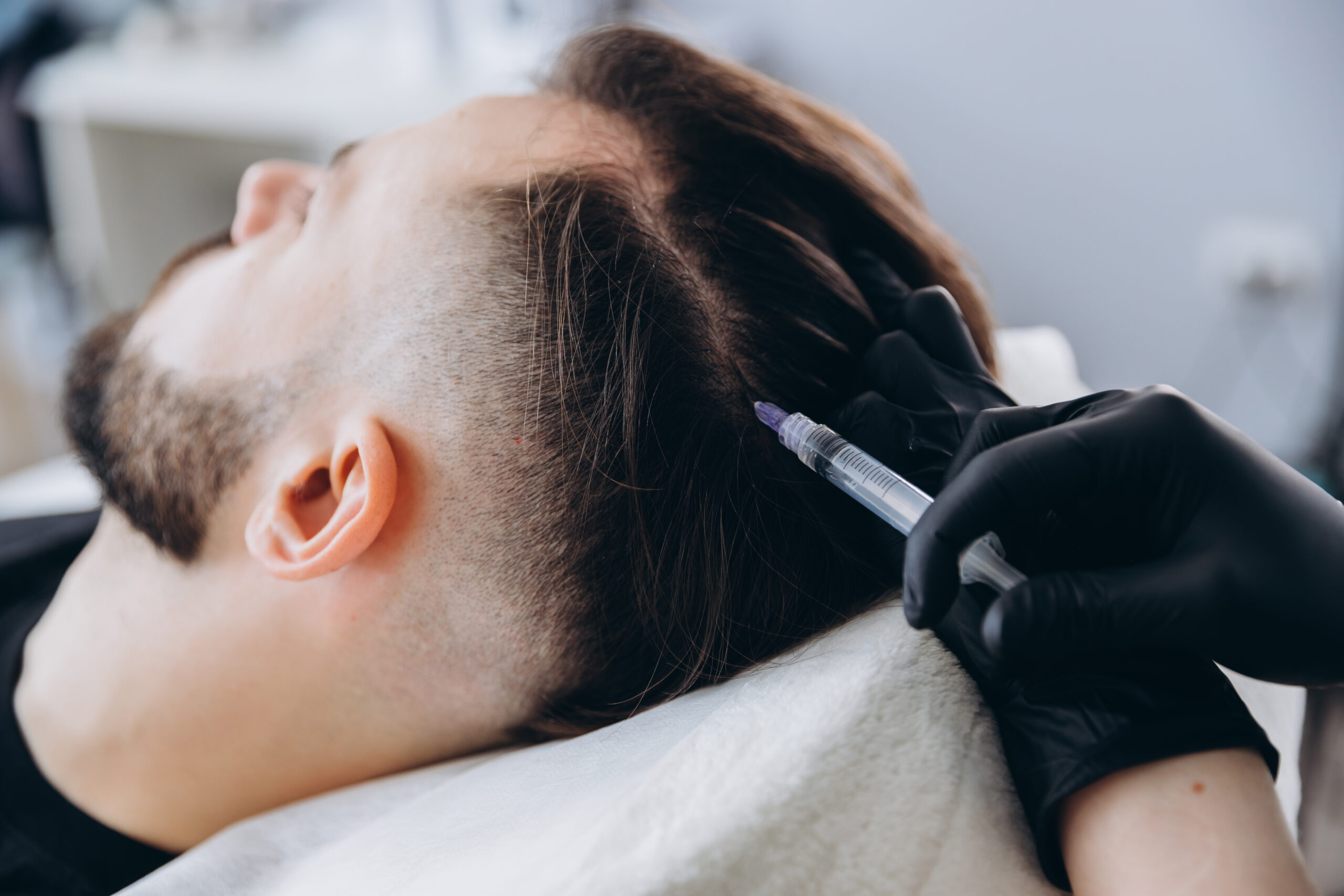 Man receiving a hair treatment with a syringe in a salon, showcasing a close-up of the procedure. The stylist wears black gloves and focuses on the client's scalp, emphasizing hair restoration techniques.