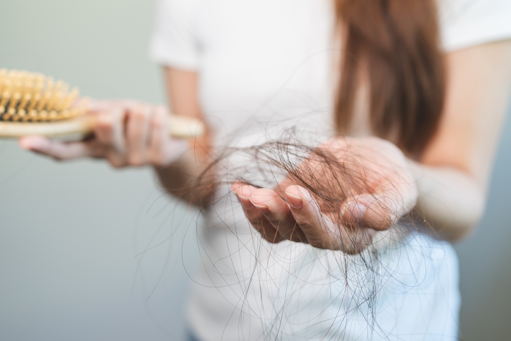 A woman holding a hairbrush in one hand and strands of hair in the other, illustrating hair loss.