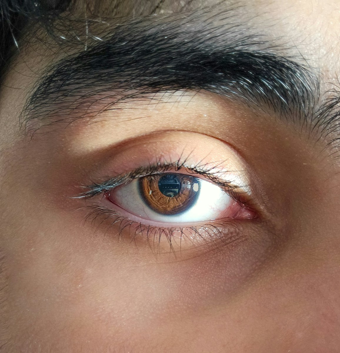 How to Get Rid of Under-Eye Bags: The Best Med Spa Treatments for Tired Eye