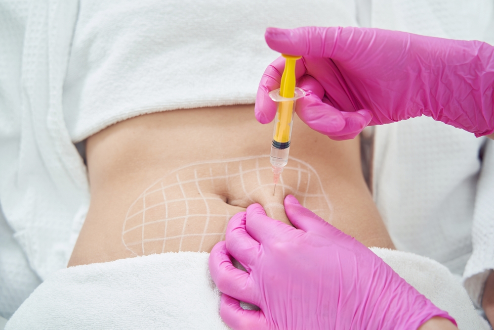 Fat-Dissolving Injections Beyond the Chin: Emerging Uses for Body Sculpting