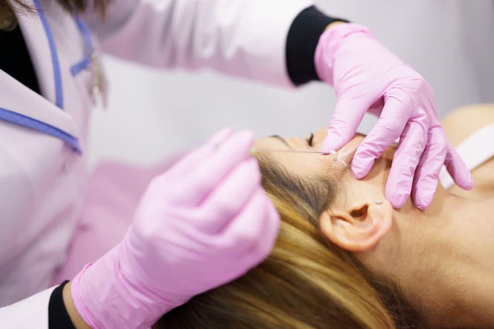 The ABCs of PDO Threads for Brow Lifts and Fox Eye Contours